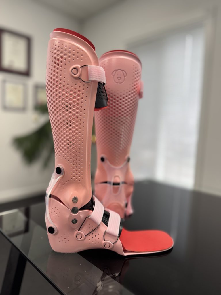 Pink custom articulated (hinged) ankle foot orthoses with ankle joints, made by WingTek