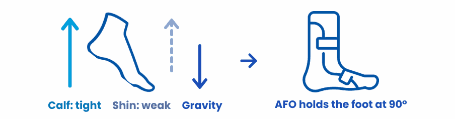 Diagram: a tight calf, weak shin muscles and gravity pull the toes down. An AFO holds the foot at 90 degrees.