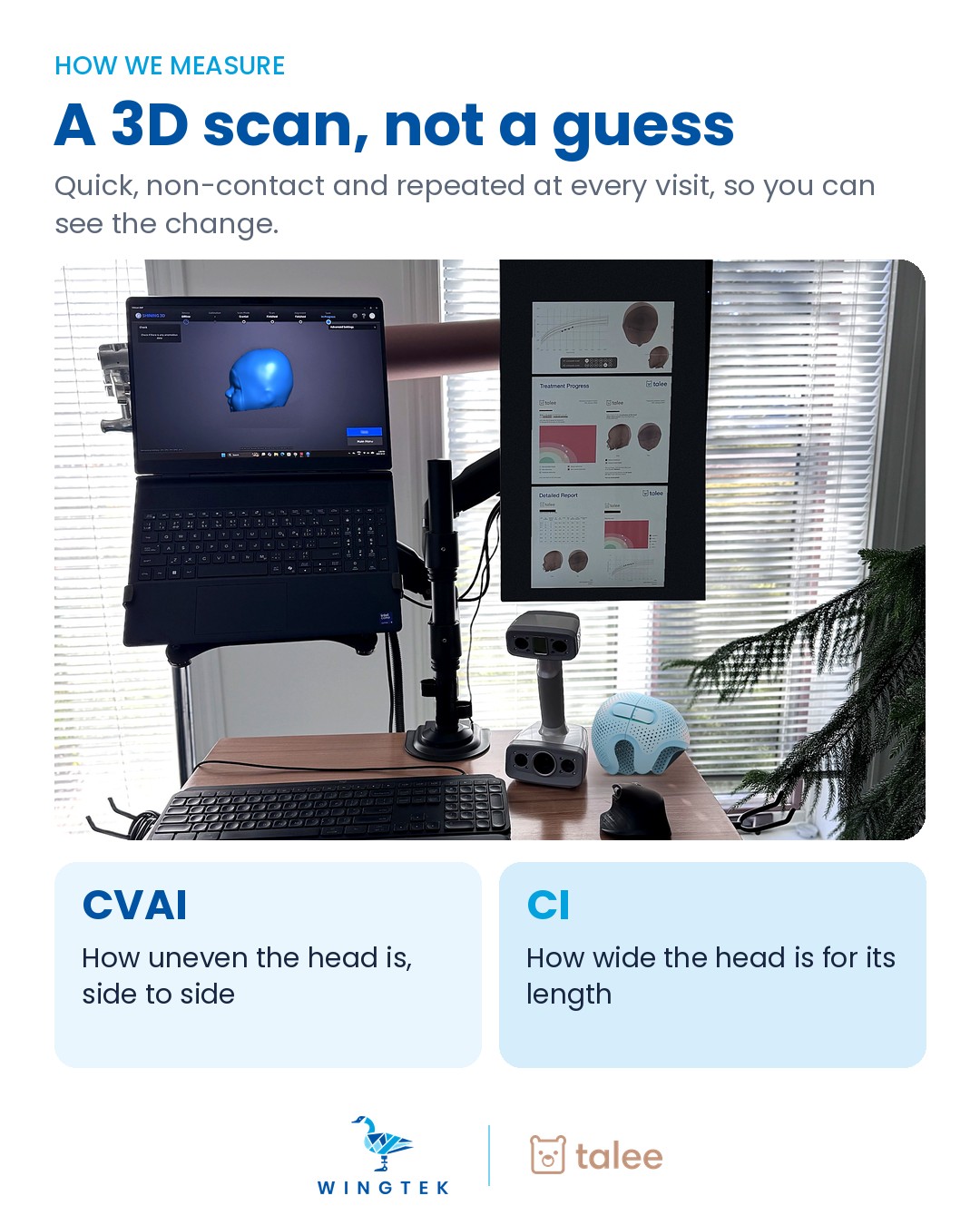 WingTek's 3D head scanning station in Emerald Park near Regina, with a handheld EinScan H scanner, Talee treatment reports and a Talee baby helmet