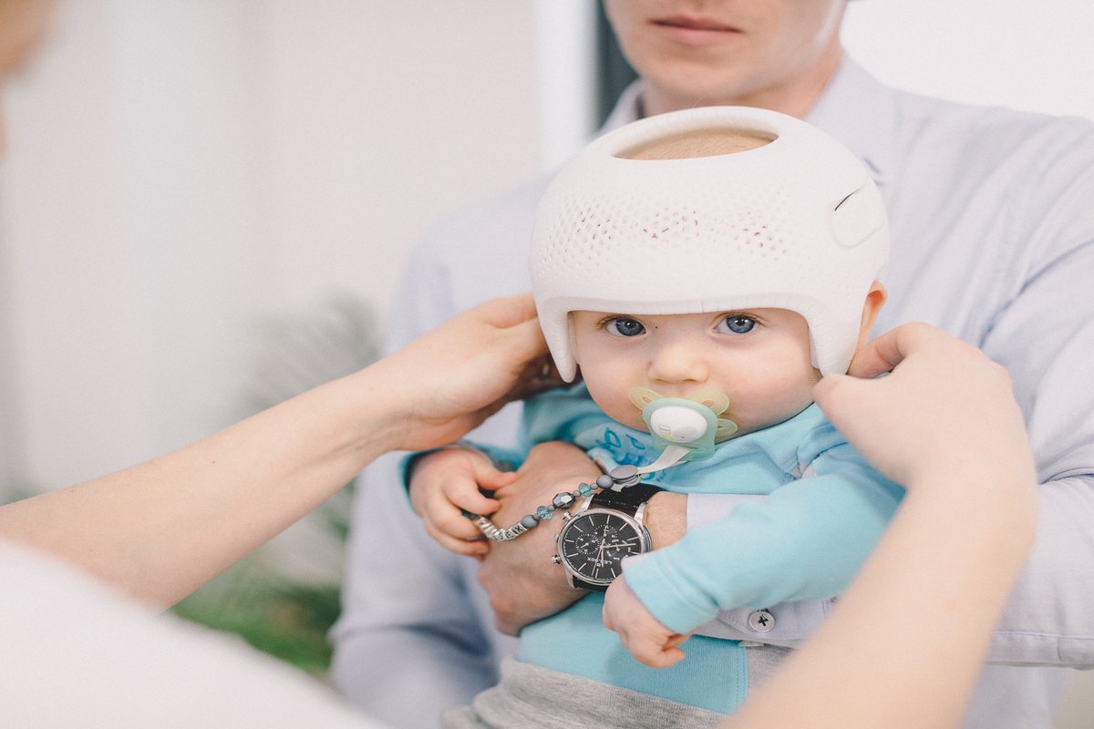 Baby wearing a Talee cranial remolding helmet for flat head during a fitting