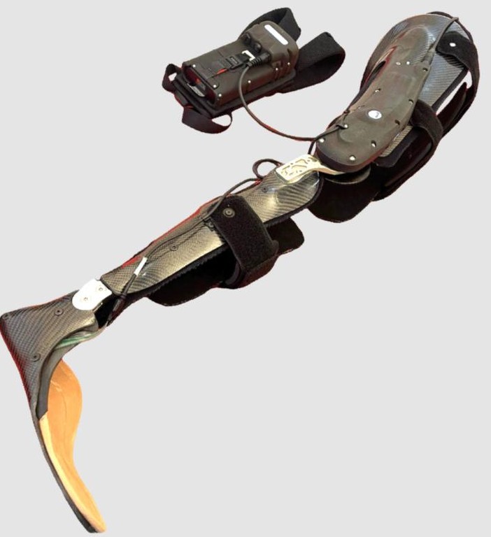 Carbon fibre knee ankle foot orthosis (KAFO) with an Agilik powered knee unit and battery pack