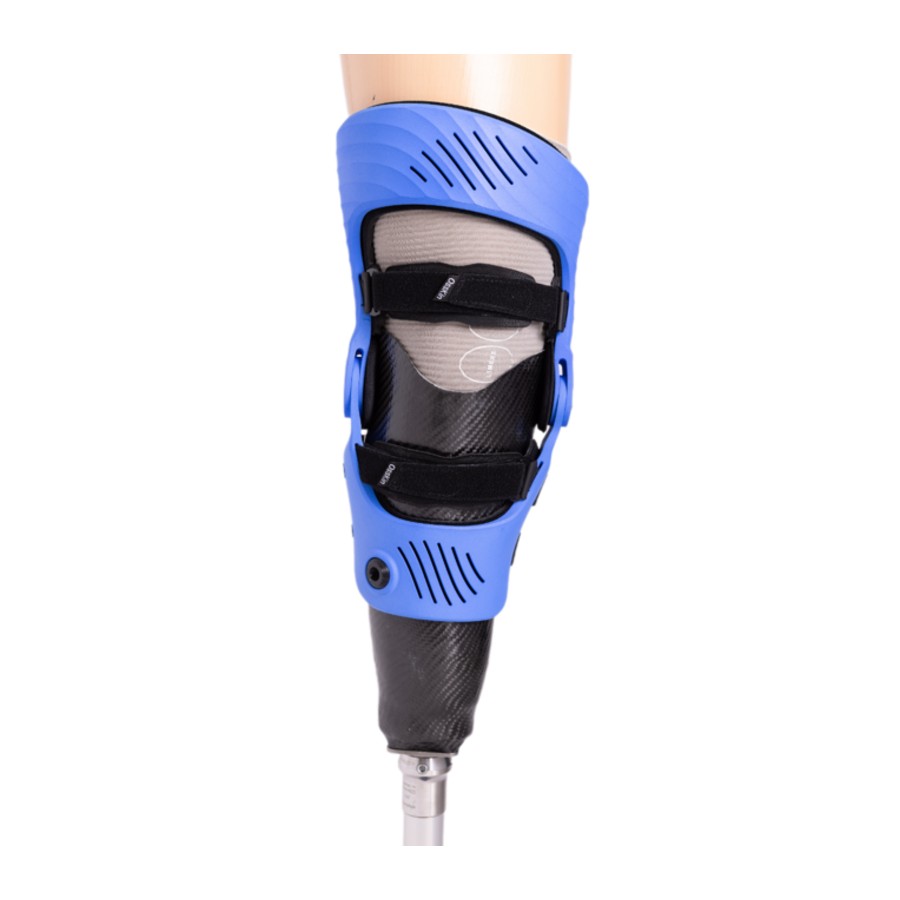 OssKin ExoStab knee brace fitted over a below-knee prosthesis