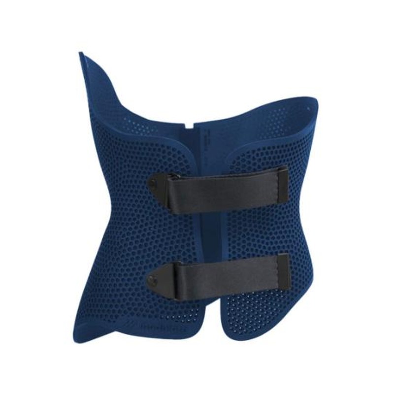 Blue 3D printed scoliosis brace with a honeycomb pattern for airflow and two front straps