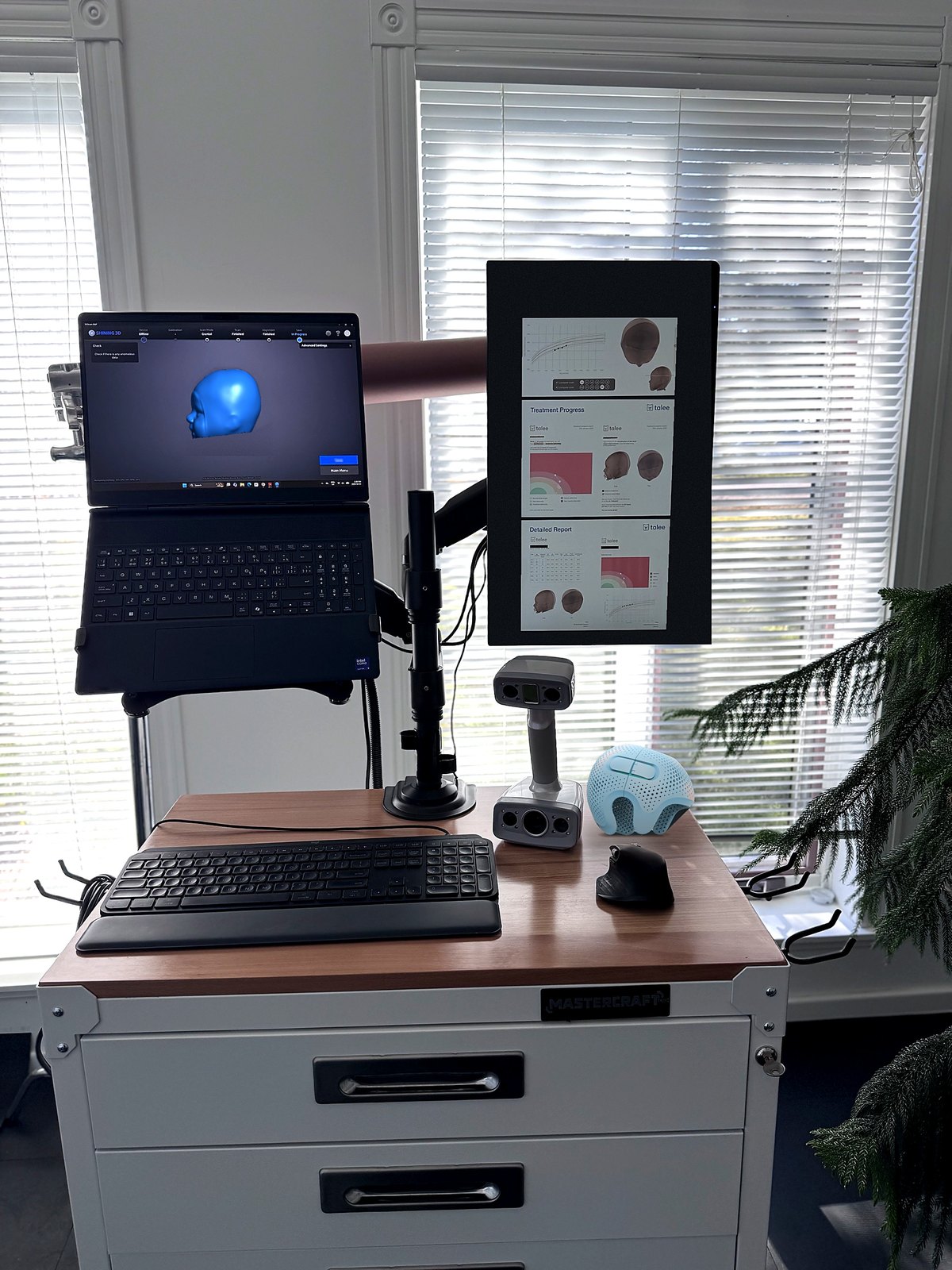 WingTek 3D head scanning station for babies in Emerald Park near Regina, with an EinScan H scanner, Talee treatment reports and a Talee baby helmet