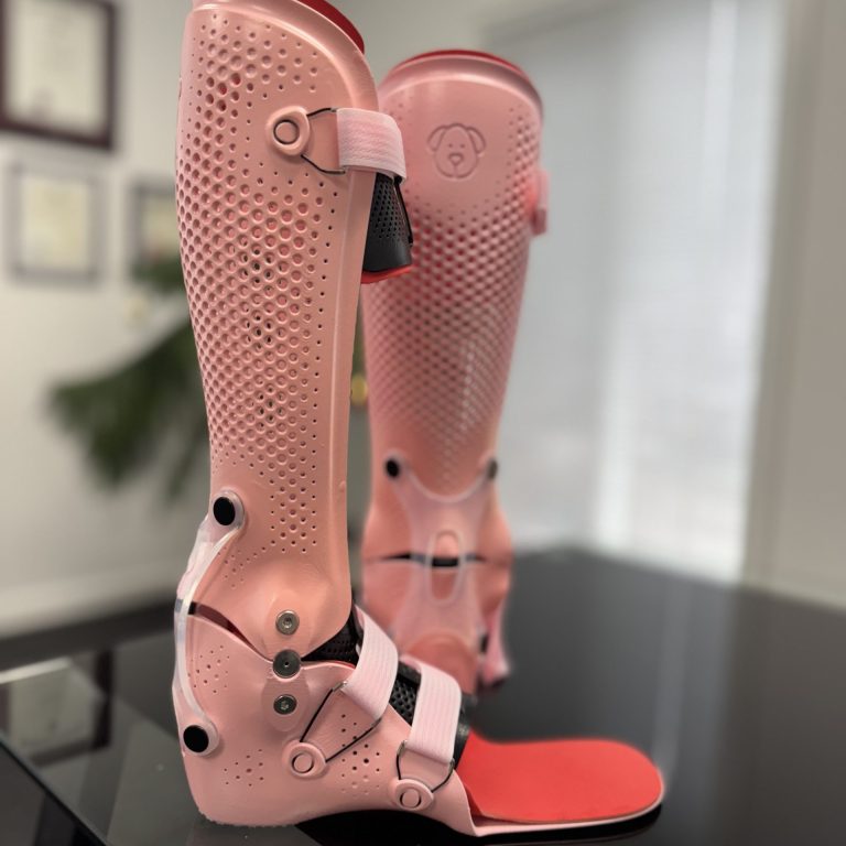 Articulated-AFOs_Pink_X-Tension-Strap_Toe-Walking-orthotics_Regina_Sask_Emerald Park