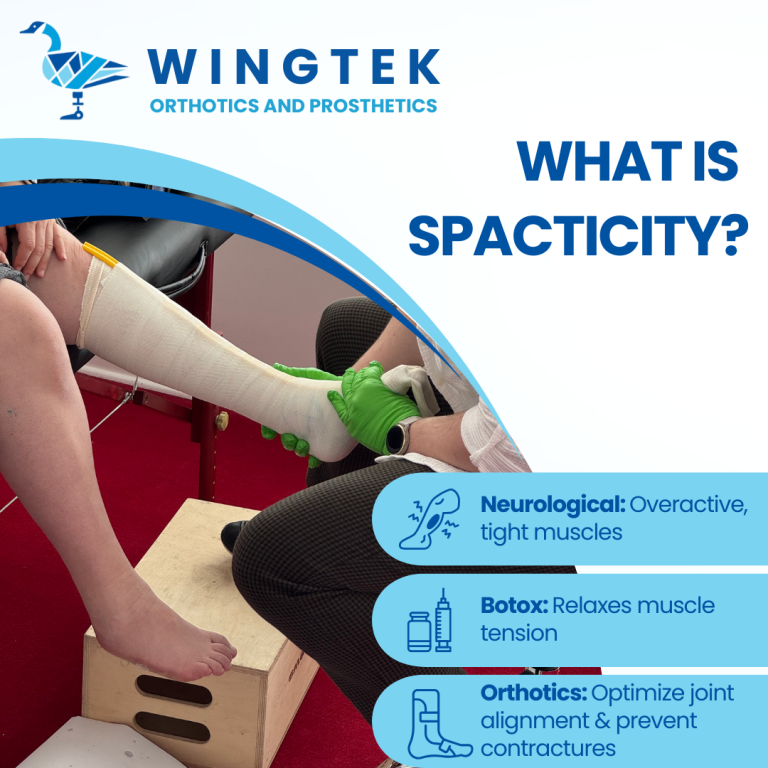 What is Spacticity